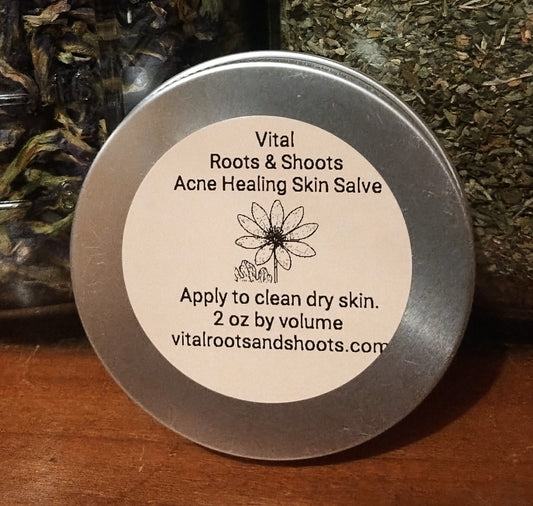 Acne Healing Skin Salve